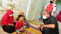 Gubernur Sumut Jeguk Dua Anak Penderita Kulit untuk Dirujuk ke RS Haji Medan
