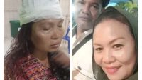 Resmi Pasutri Jadi Tersangka Aniaya Lilis Suriani Br. Sembiring, Terancam 5 Tahun Penjara