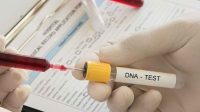 Tes DNA Hasil Tes DNA Ungkap: Ridwan Kamil Bukan Ayah Biologis Anak Lisa Mariana