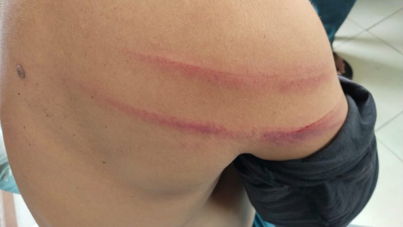 “Ninja Sawit” Serang Satpam PTPN IV Kebun Silau Dunia di Simalungun