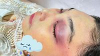 LBH Medan Duga Kematian Winda Lorenza Gowasa Bukan Bunuh Diri, Desak Pengusutan Transparan