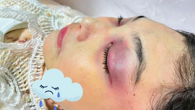LBH Medan Duga Kematian Winda Lorenza Gowasa Bukan Bunuh Diri, Desak Pengusutan Transparan